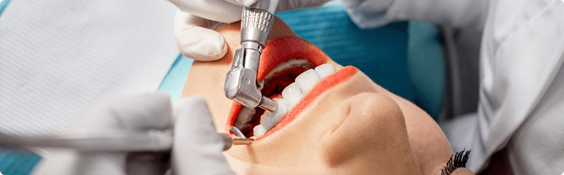 Процесс чистки зубов у стоматолога