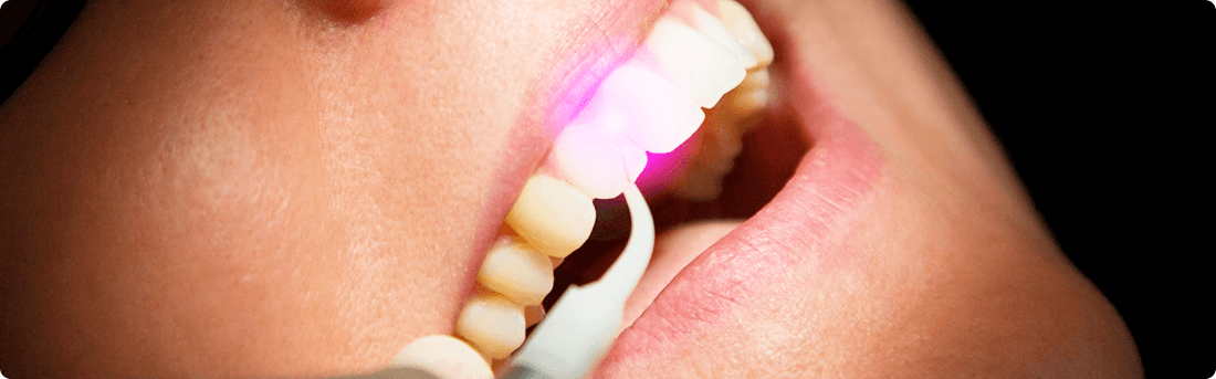 Пломбирование зубов в будущем