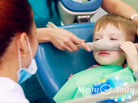 Седация закисью азота для лечения зубов ребенку