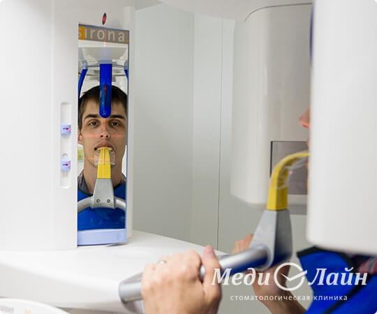 Процедура 3D томографии