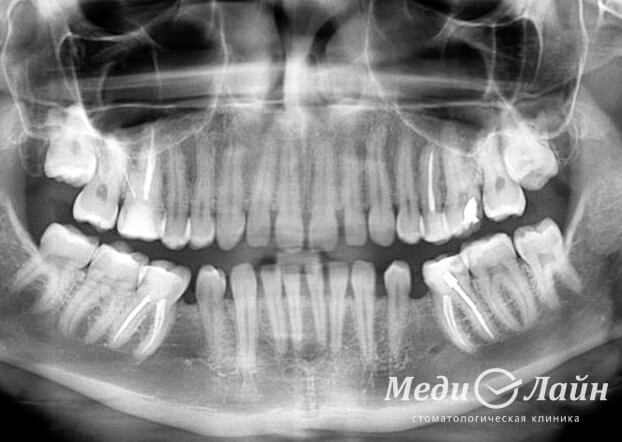 Панорамный снимок зубов Томск Левобережный стоматология на енисейской томск
