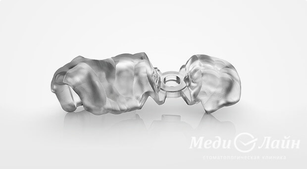 Работа с хирургическим шаблоном