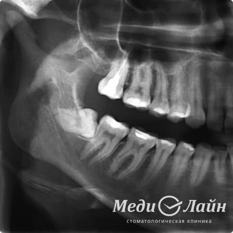 Лежачие восьмерки