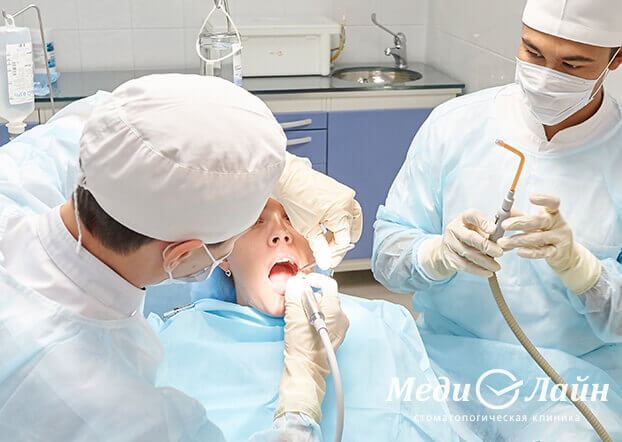 Хирургическое вмешательство по удалению кисты и верхушки корня зуба