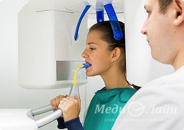 Компьютерная томограмма дает самую подробную и полную информацию о ваших зубах