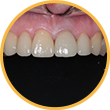 Снимки зубных рядов в полости рта