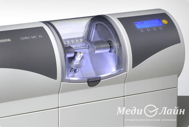 Вкладки изготавливаются с помощью аппаратного комплекса CEREC