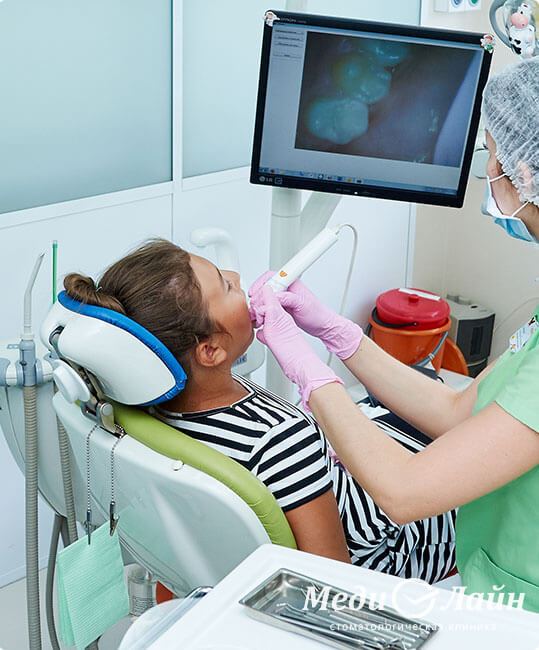 Внутриротовая камера - увидеть все проблемы своими глазами