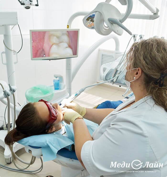 Внутриротовая камера - прозрачная диагностика полости рта